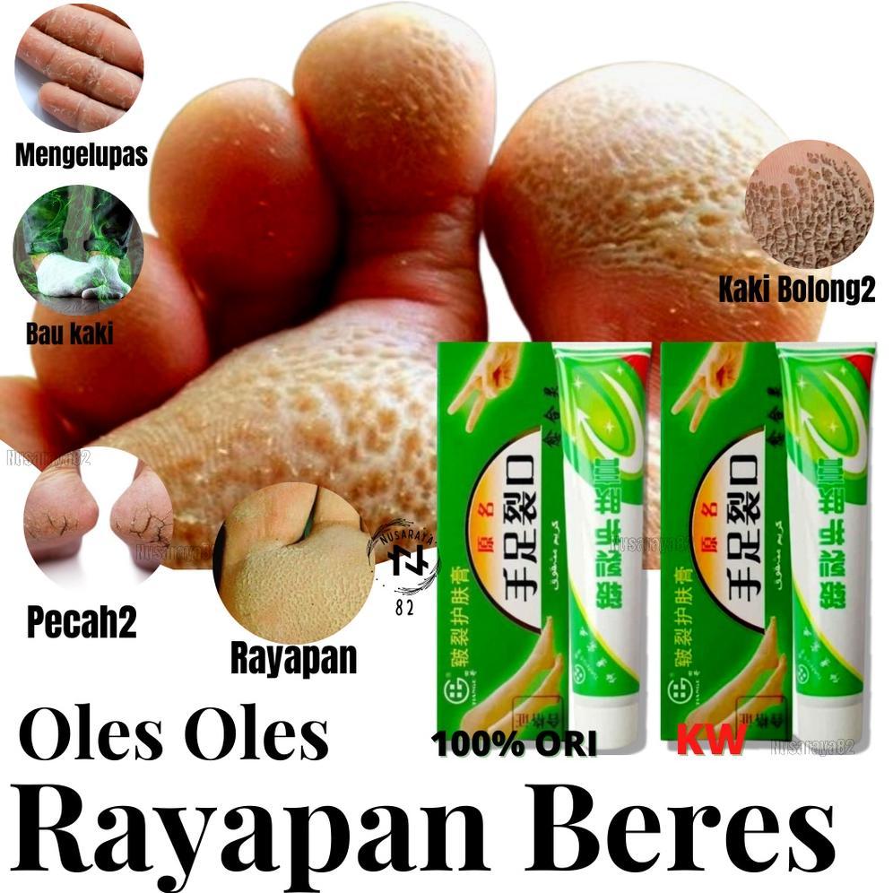 CantikQ- Salep Kutu Air Untuk Kaki Paling Ampuh Obat Telapak Kaki Pecah Pecah2 Dan Kering Penghalus 