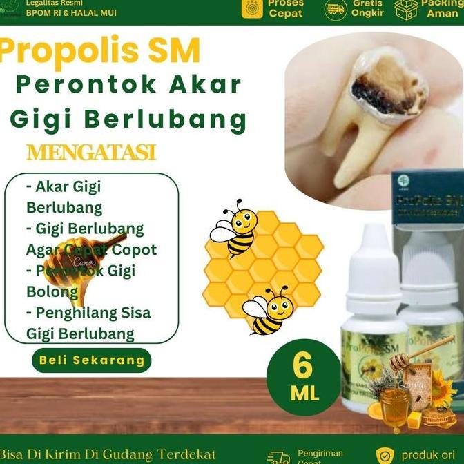 Grl- Propolis Sm Perontok Akar Gigi Berlubang, Perontok Gigi Bolong, Penghilang Sisa Gigi Berlubang,