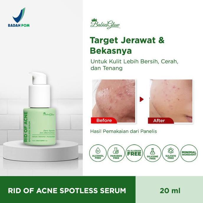 Babies Glow - Rid of Acne Spotless Serum