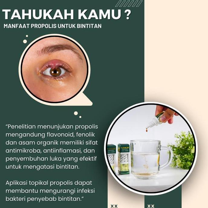 Cleaanea- Propolis Sm Herbal Bintitan Mata, Kelopak Mata Bengkak, Bisul Dikelopak Mata, Kalazion, Pe