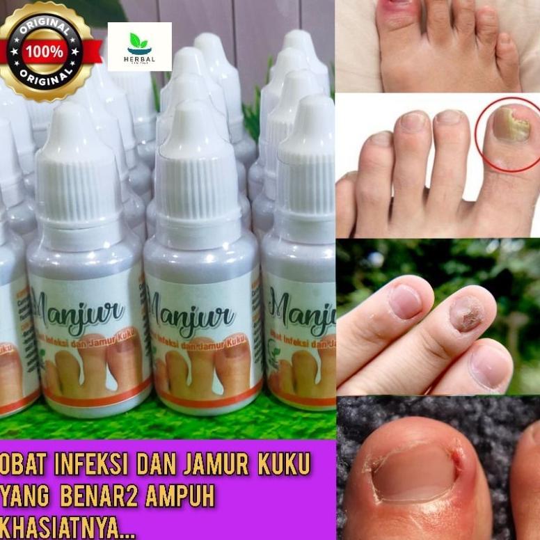 Obat Kuku Anti Infeksi Jamur Bakteri Cantengan Bau Busuk Gatal Menguning Bernanah Sakit Bengkak Mene