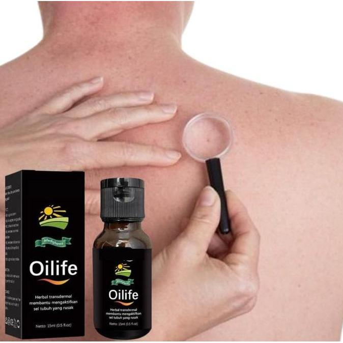 Vitbig- Oilife - Minyak Oles Benjolan Di Punggung Original Bpom