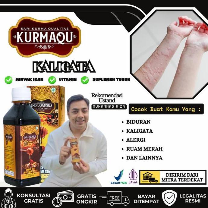 Biduran, Alergi, Kaligata Akut, Gatal-Gatal, Kaligata Menahun, Ruam, Bintik Merah - Kurmaqu