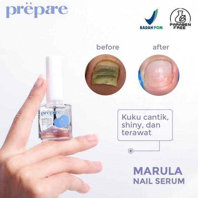 janisetyovikgeh - perawatan kuku cantengan vitamin kuku obat kuku rusak serum kuku dan tangan obat c