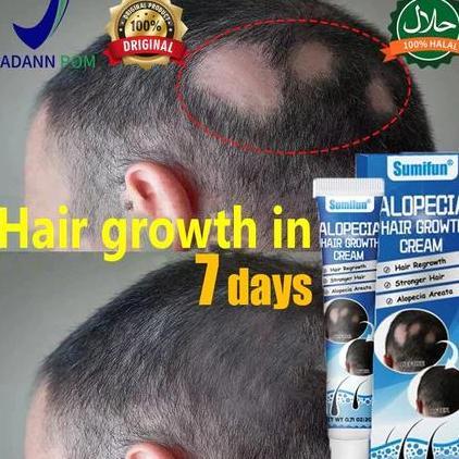 Haircare- Obat Alopecia Areata, Obat Penumbuh Rambut Botak, Obat Botak Koin, Obat Rambut Pitak, Obat