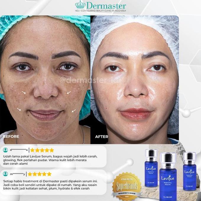 Dermaster Dry Brightening Package Original