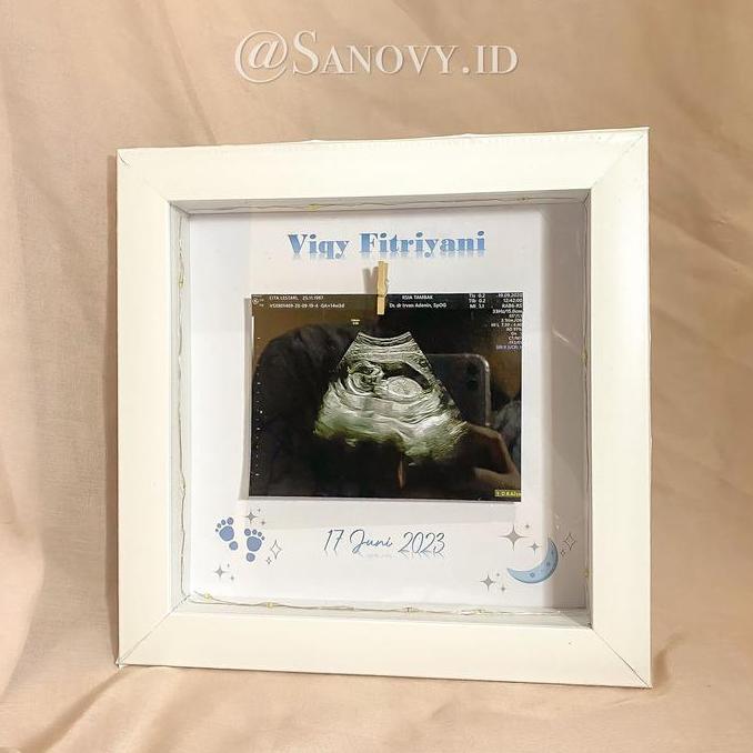 2020012 Pigura / frame 3d USG Baby Photo Frame murah