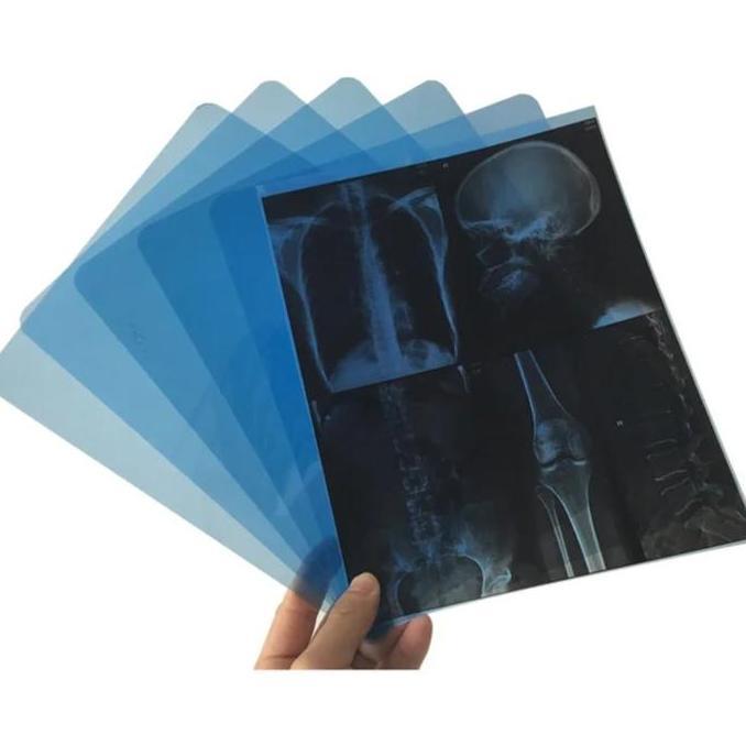 DIGITAL FILM INKJET MEDICAL DRY FILM A4