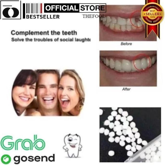 SHANUMID2 Fident Penambal Gigi TF