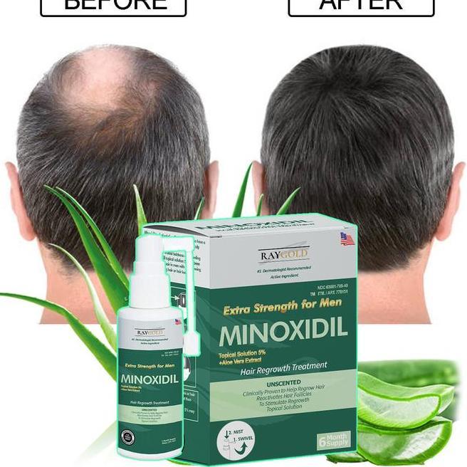 Minoxidil 5 Penumbuh Rambut Brewok With Aloe Vera For Men Made In Usa Raygold Minox Minoksidil Anti 