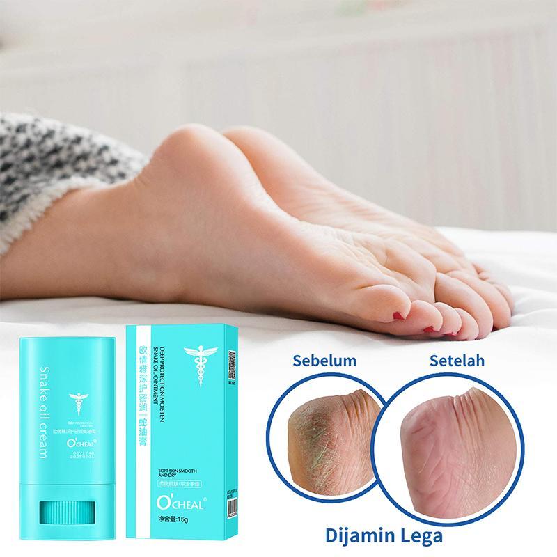 Krim Kaki Pecah-Obat Kaki Pecah2 Dan Kering Yang Ampuh-Obat Kaki Pecah Pecah-Salep Kaki Pecah2 Dan K