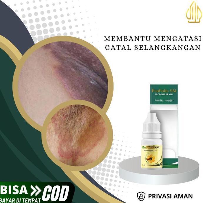 Propolis SM - Salep Gatal Selangkangan, Pemutih Selangkangan Hitam, Kurap Di Selangkangan, Selangkan