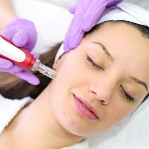 Dermapen MYM BB Glow Derma Pen, Anastesi, dan Serum [terbaik]