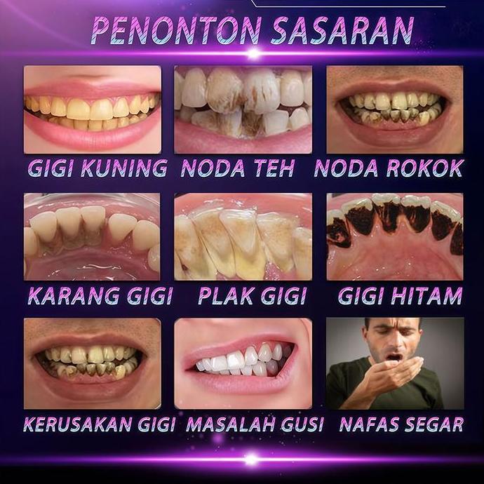 Whtting- Bpom 7 Hari Uji Coba Ouzi Bubuk Gigi Pergi Gigi Kuning Gigi Hitam Plak Gigi Karang Gigi Naf
