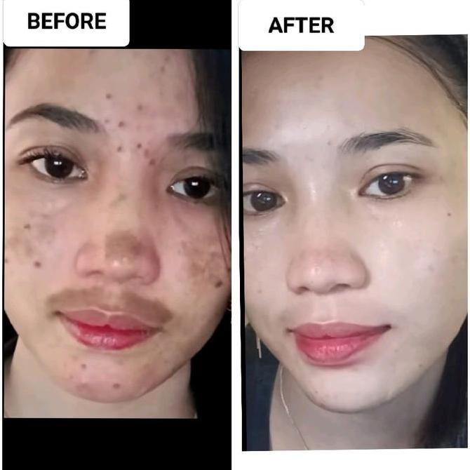 Cantikjamin Js Skincare Ready Brigtening Night Cream  Js Skincare Exclusive Krim Glowing/ Krim Flek 