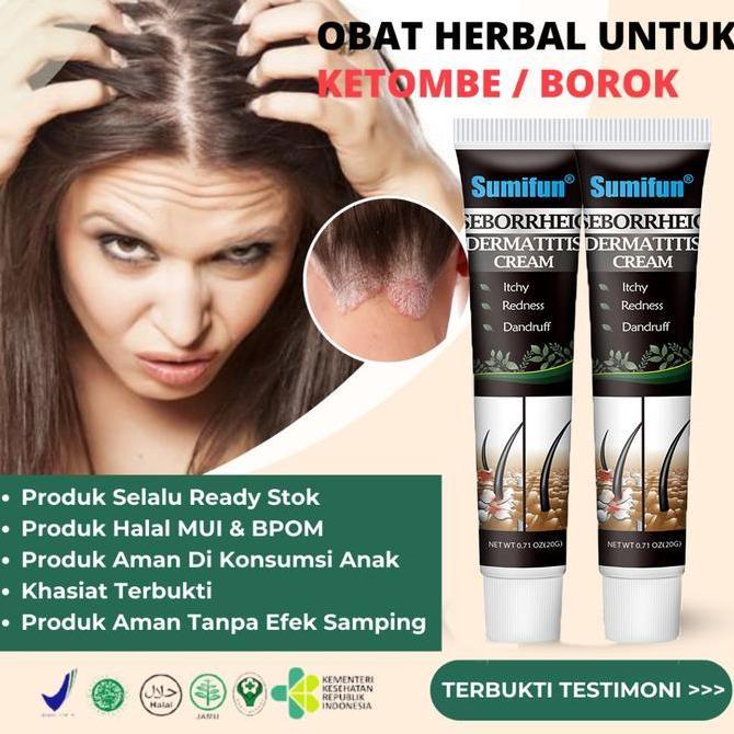 Haircare- Obat Ketombe Parah Scalp Itching Anti Itching Cream Obat Psoriasis Di Kepala Eksim Kulit K