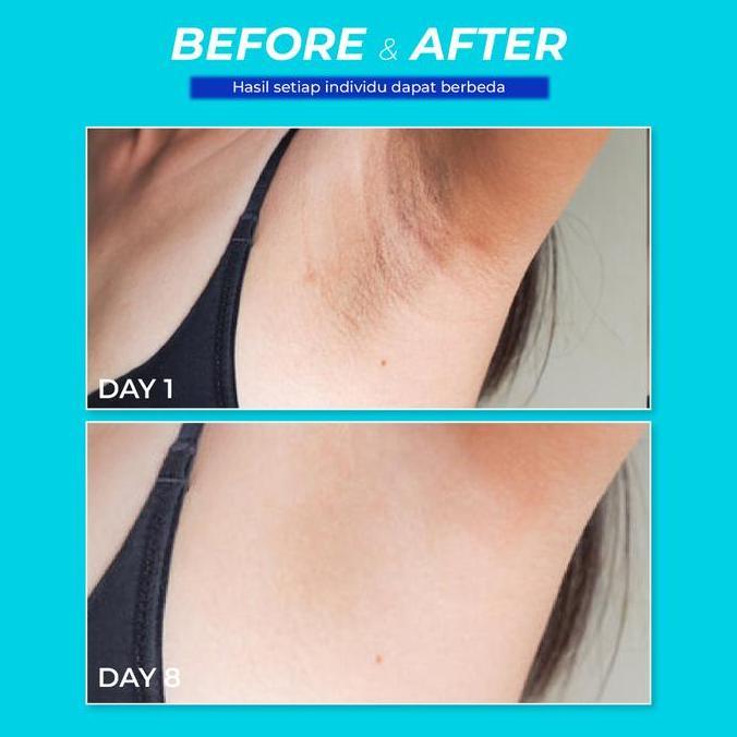 Bytxc- Smart Breast Keti Line Glow Brightening Cream | Pemutih Ketiak