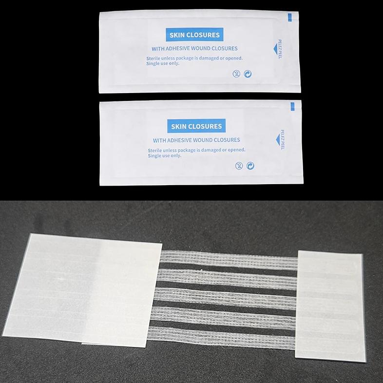 Sterile Strip Scar Away Acne Scar Marks Remover Sterile First Aid Travel Wound Skin Closures Medical