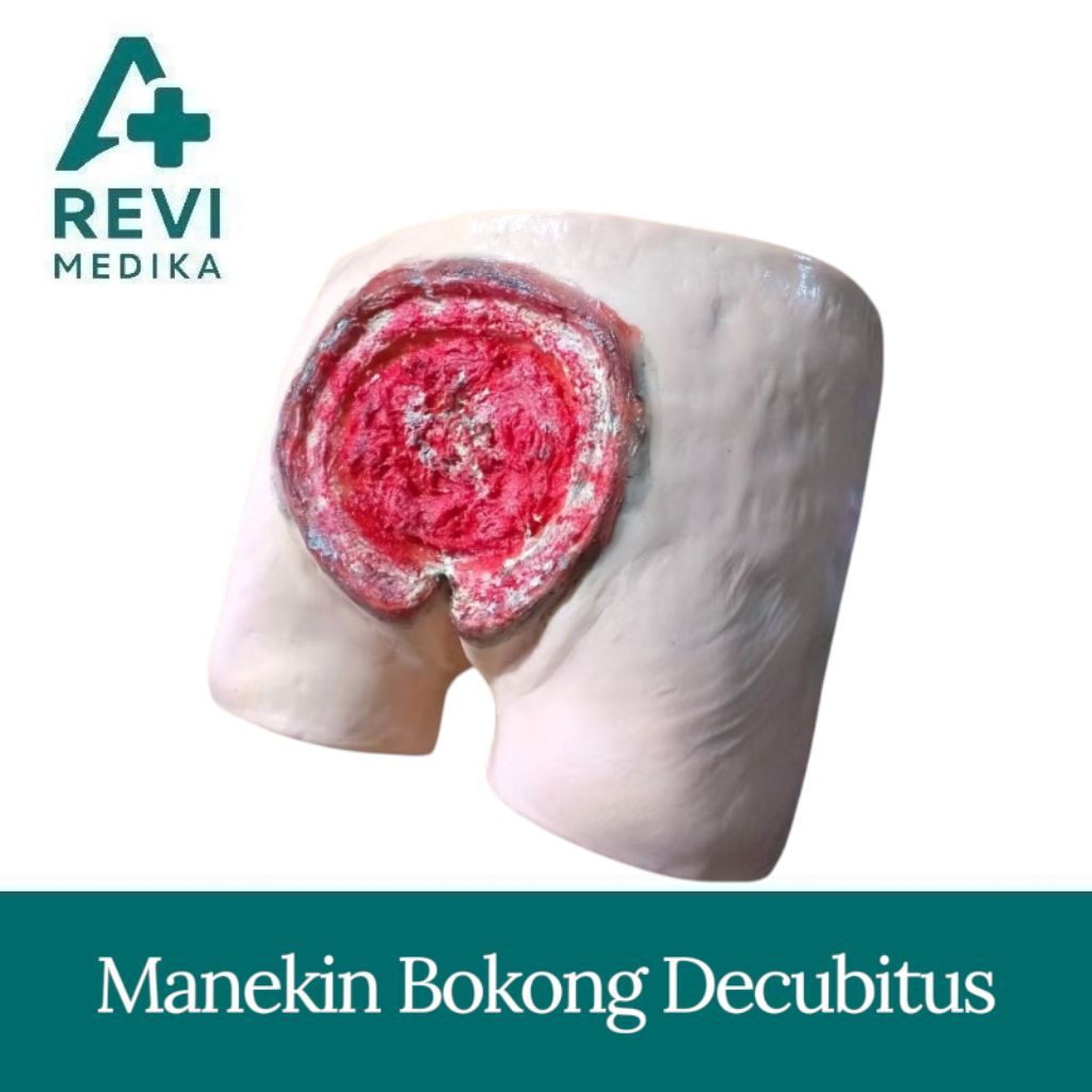PHANTOM MANEKIN BOKONG DECUBITUS/ MANIKIN PERAGA BOKONG LUKA DECUBITUS