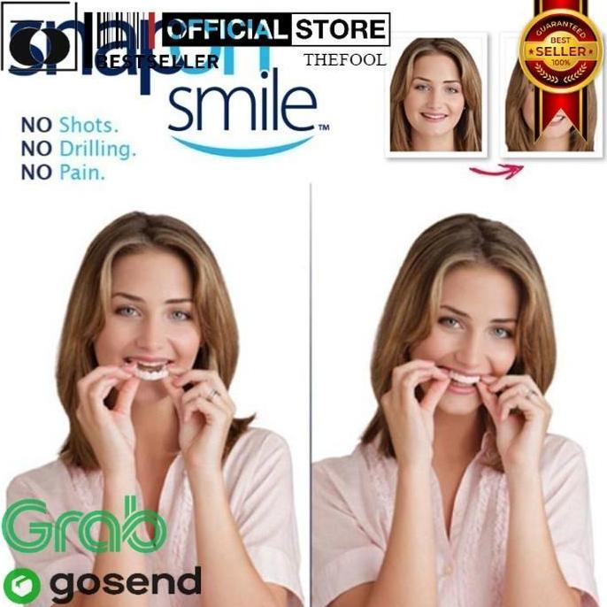 SANDMATEKNO SET VENEER PELAPIS GIGI OMPONG - SEPASANG ATAS DAN BAWAH TF