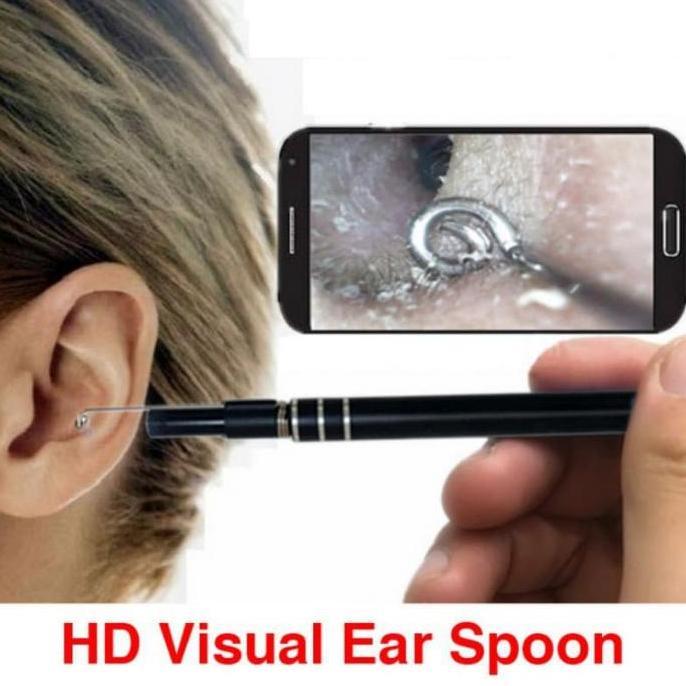 Medclean- Kamera Otoscope 3In1 Usb Endoskopi Kamera Endoskop Ear Cek Telinga