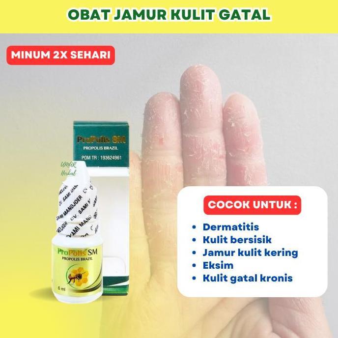 Obat Dermatitis Kulit Kering Gatal Bersisik Mengelupas Propolis SM JAMIN ORI