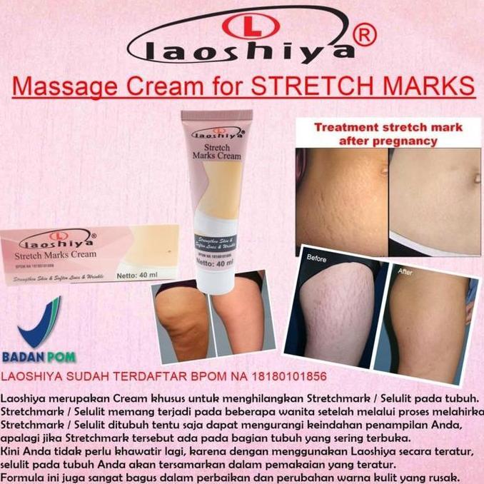 LAOSHIYA STRETCH MARKS CREAM TRETCH MARKS LAOSHIYA