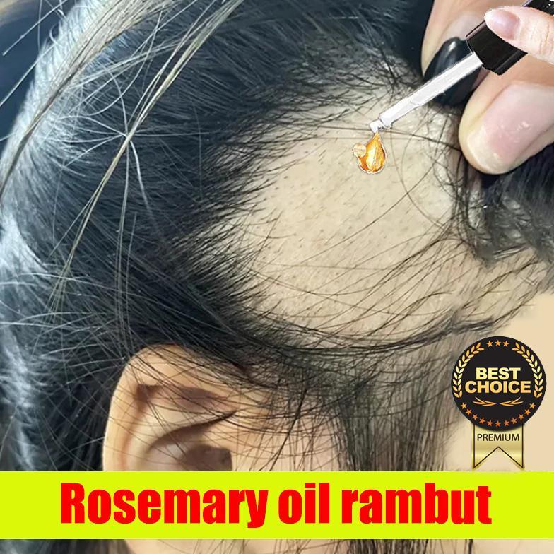 ORI Penumbuh Rambut Botak Alami | Rambut Rontok & Kebotakan Rambut penumbuh rambut botak Penebal ram