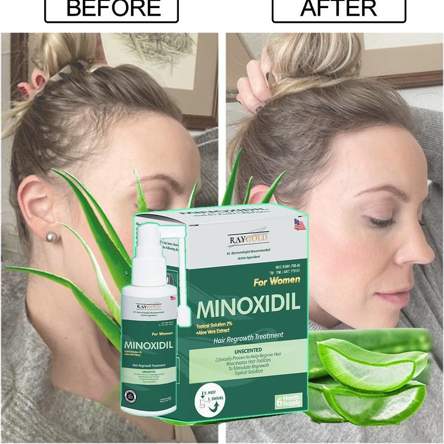 Minoxidil 2% For Women Penumbuh Rambut With Aloe Vera Made In Usa - Raygold - Minox Minoksidil Minok