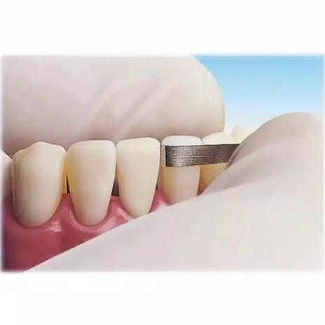 slicing ortho horico grinding steel strips kikir gigi manual dental ab