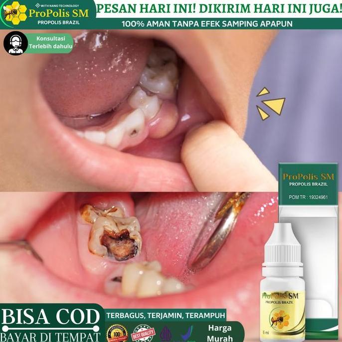 Obat Penghancur gigi Berlubang, Perontok Akar Gigi dan Karang Gigi