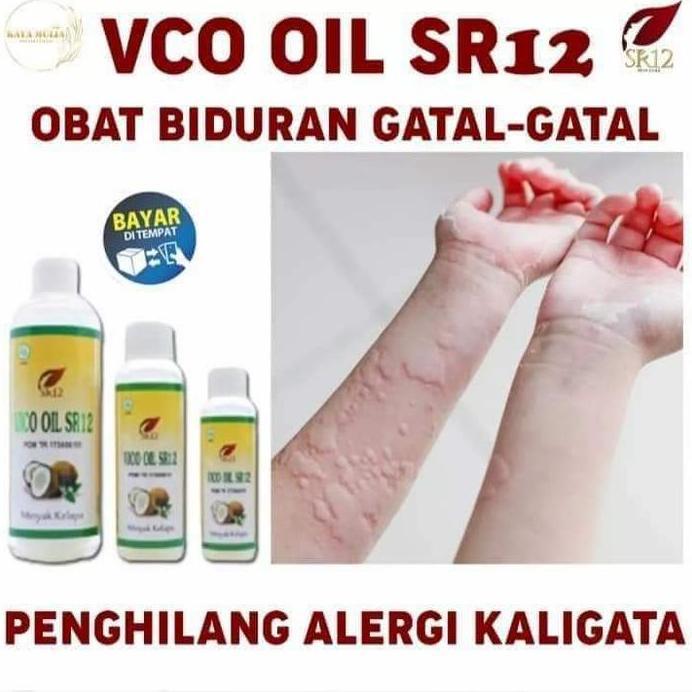 AMPUH OBAT PENYAKIT BIDURAN / OBAT PENYAKIT ALIGATA / DARAH DINGIN