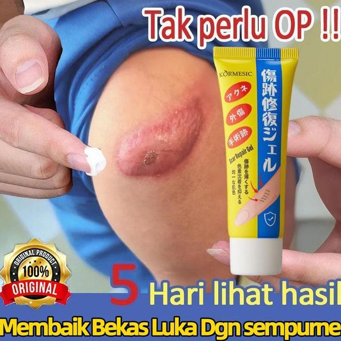 Bodies- Salep Penghilang Bekas Luka Penghilang Bekas Luka Hitam Koreng Obat Penghilang Bekas Luka Me