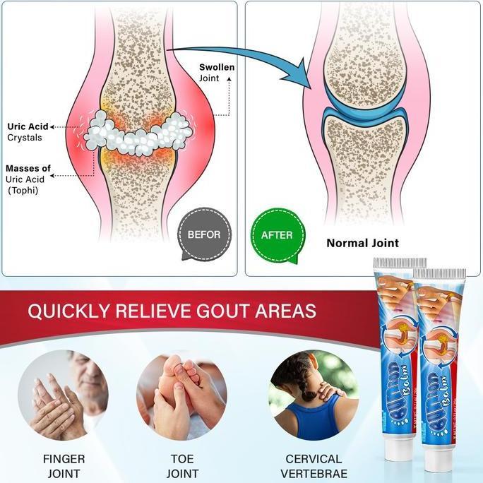 Bytxc- 100% OriObat Kebas Kesemutan Tangan Dan Kaki .Arthritis Cream Obat Rematik Salep Pereda Sakit