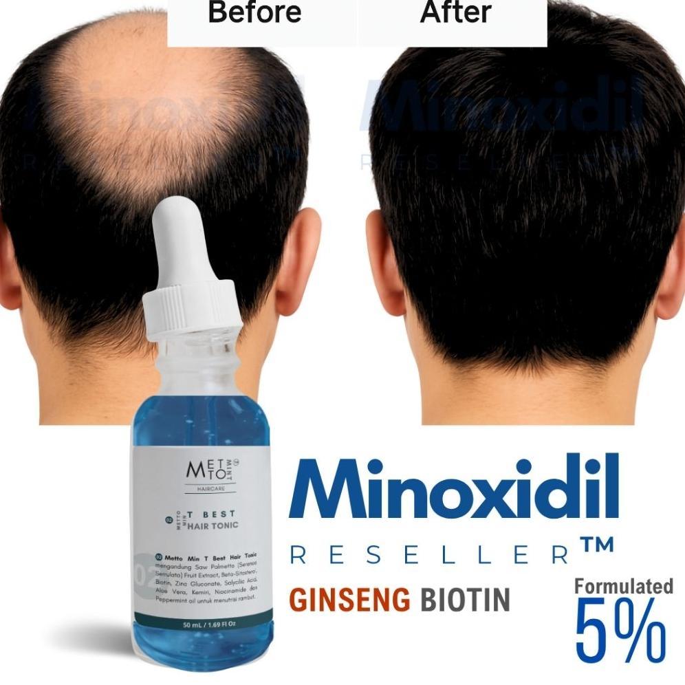 MINOXIDIL 5% Reseller Penumbuh Rambut Ginseng Biotin Minox Reseller Minoxidil 5% Minoxidil 10% Minox