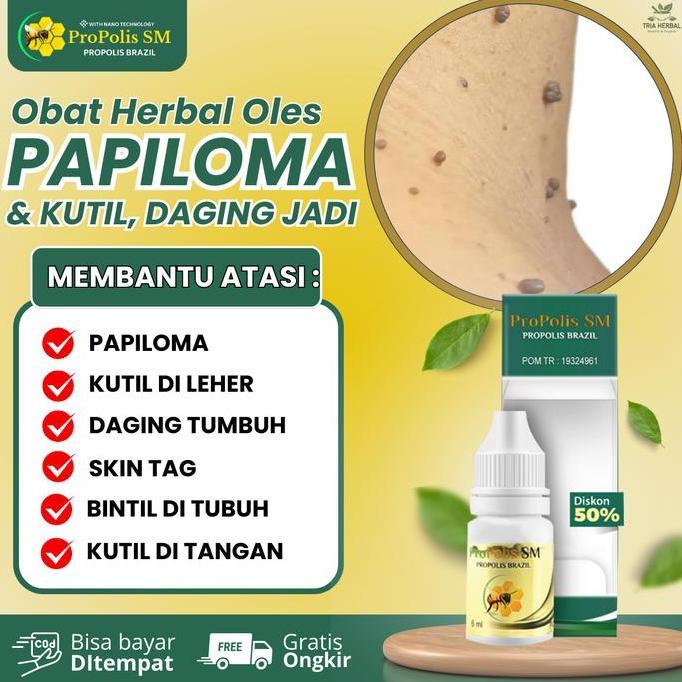 Girlcare- Propolis Sm Perawatan Kutil Papiloma, Daging Tumbuh / Skin Tag, Punggung Berjerawat, Kutil