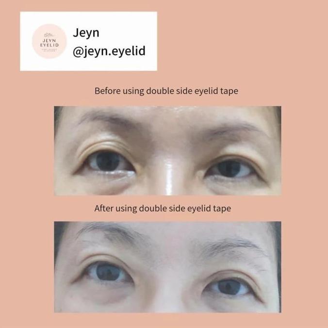 Junnismail673 - Jeyn Double Sided Eyelid Tape
