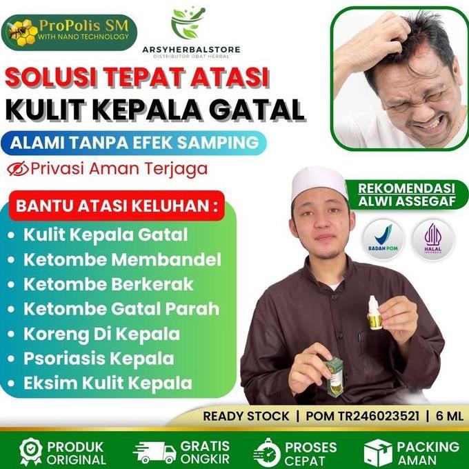 Herbal Untuk Kulit Kepala Gatal, Gatal Kulit Kepala, Psioriasis, Jamur Di Kulit Kepala - Propolis SM