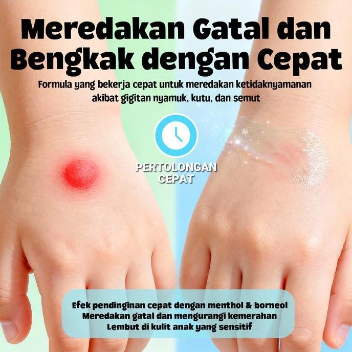 Byblue- Hegerbaby Krim Pereda Gatal Bayi - Anti Nyamuk Anak Pereda Gatal Dan Penghilang Bekas Gigita