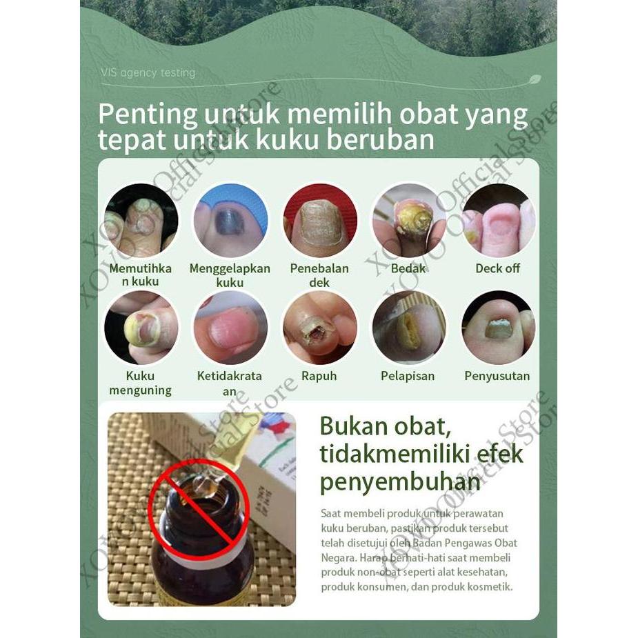Nail Repair Essence Serum Perawatan Kuku Berjamur Serum Penghilang Jamur Di Kuku  Vitamin Kuku Rusak