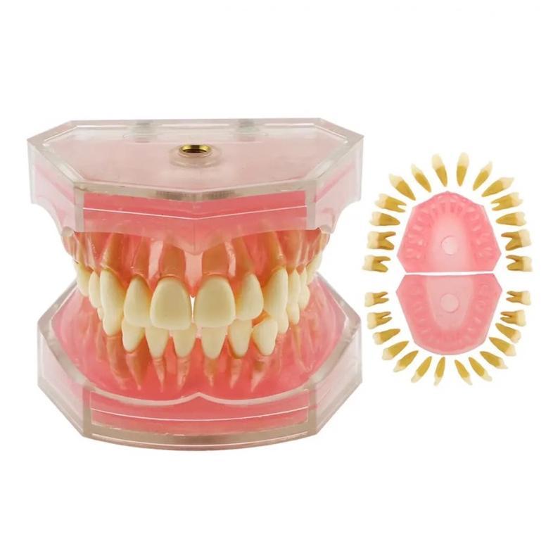 Dental study model typodont gigi bisa dilepas phantom studi edukasi gusi karet soft rubber gingiva