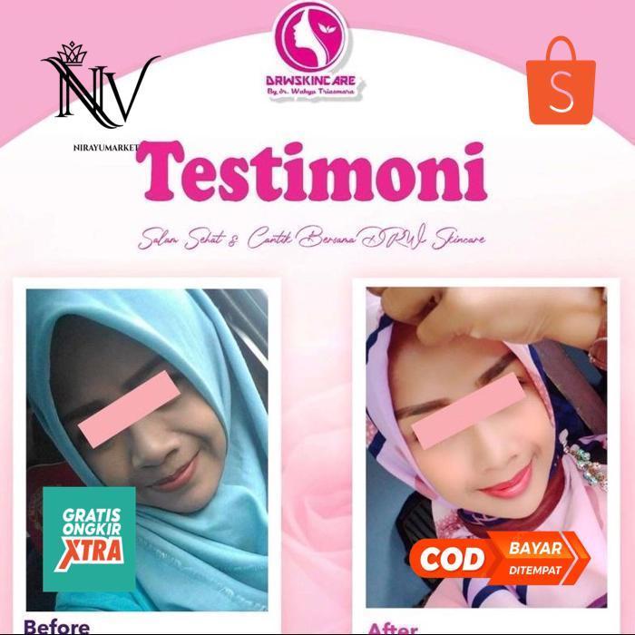 er-56 DRW Skincare Paket Radiant Formula Baru Sale