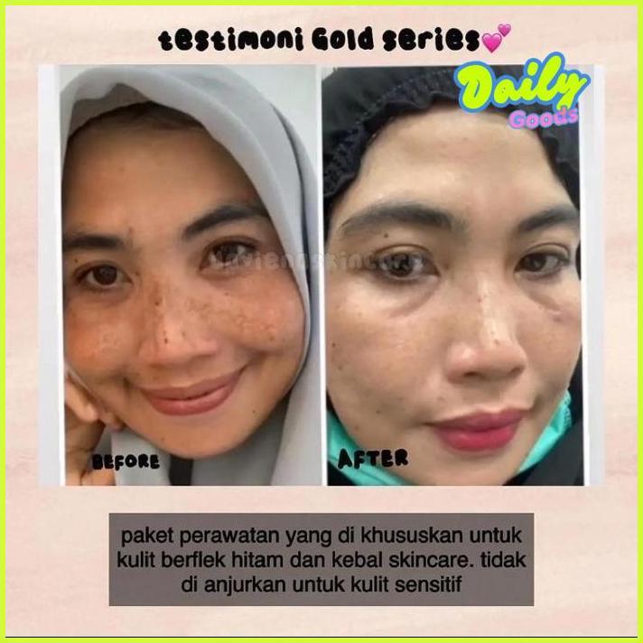 sa-324 [Official]Daviena Skincare|GOLD SERIES|PEMUTIH WAJAH BPOM DAVIENA SKINCARE|DAVINA  SKINCARE P