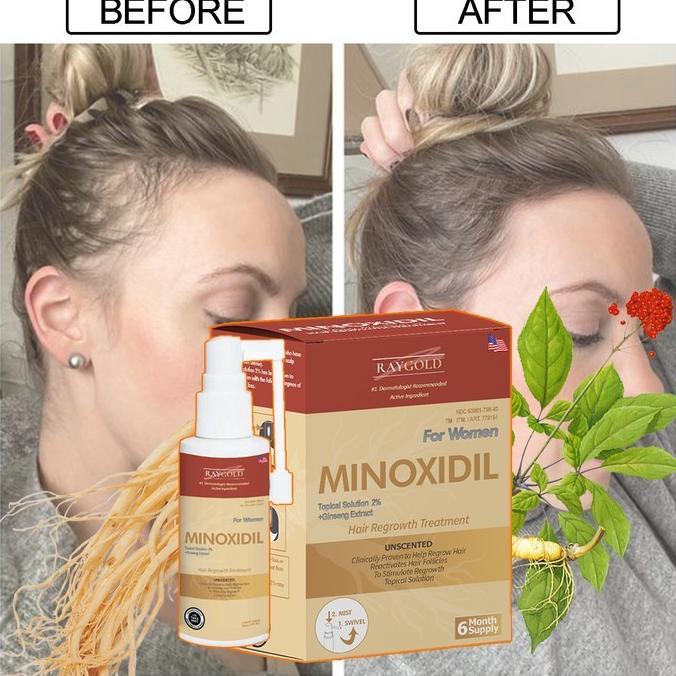 MINOXIDIL 2%for WOMEN penumbuh rambut with Ginseng extract from USA  - RAYGOLD - MINOX MINOKSIDIL an