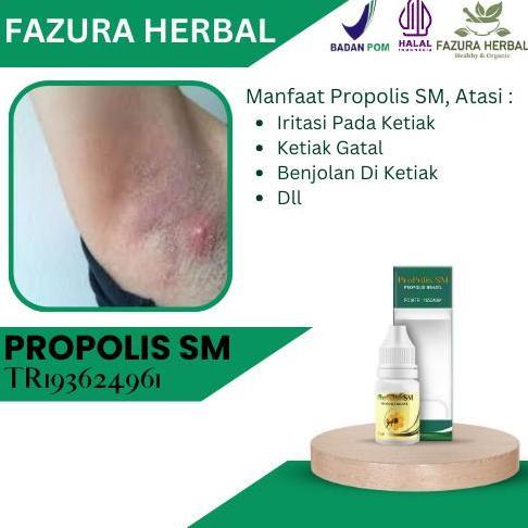 Sale Propolis Sm - Obat Iritasi Pada Ketiak, Obat Ketiak Gatal