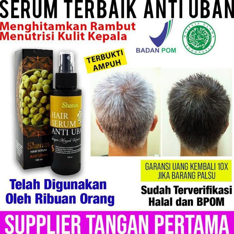 Obat uban rambut permanen - Obat uban paling ampuh - Obat uban original - Serum uban shanas - Obat u