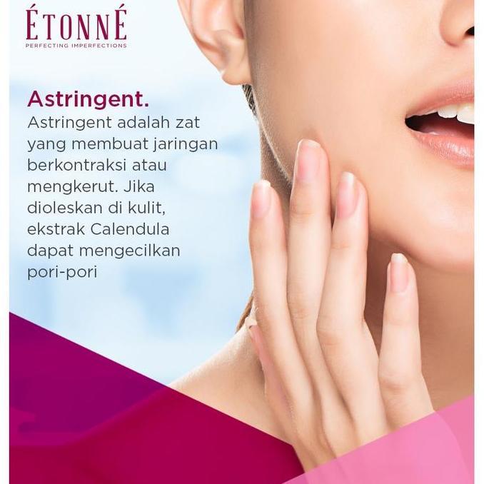 Murah Etonne Calendula Skin Care Cream Krim Anti Nyamuk Luka Bakar Iritasi Kulit Antiseptik Septik S