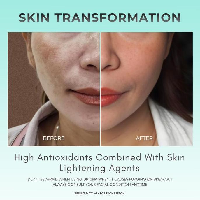 Langsung- Dricha Lightening Cream (Brighten Skin) Acid Aging