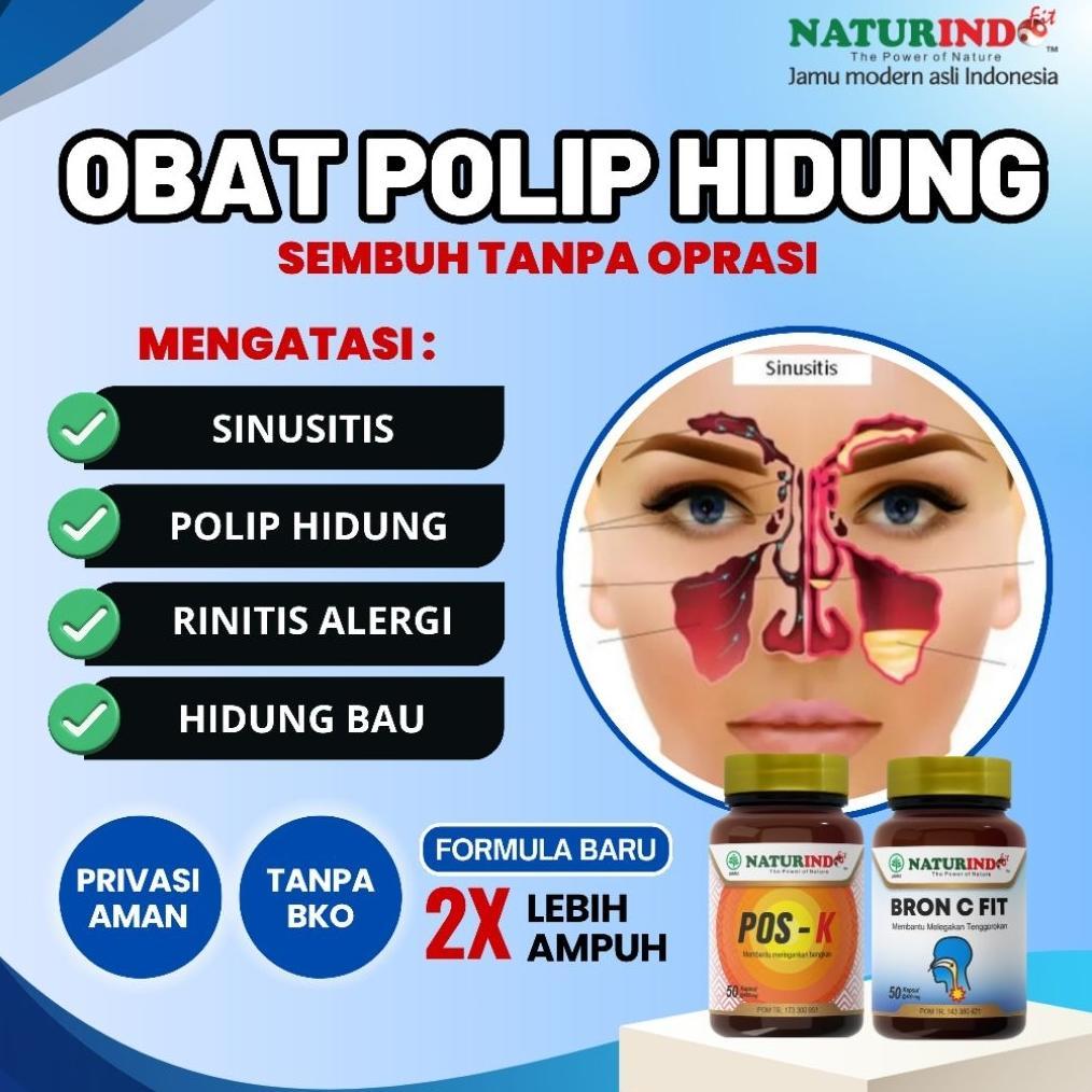 Polip Hidung Sinusitis Rhinitis Alergi Herbal Ampuh