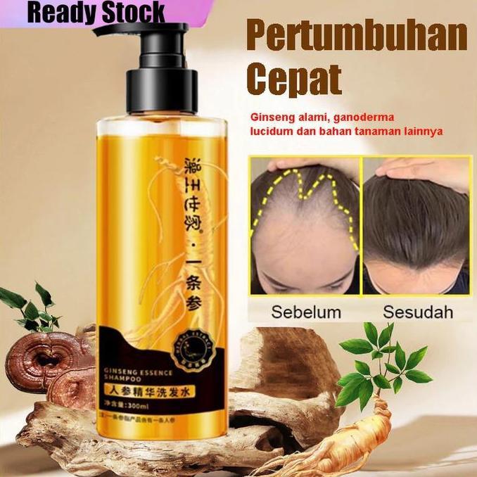 Shampoo Penumbuh Rambut Cepat Ginger Shampoo 300Ml Shampoo Penumbuh Rambut Shampoo Anti Rontok Shamp